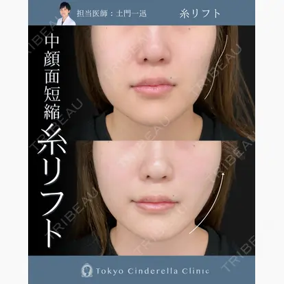 土門 一迅先生の症例