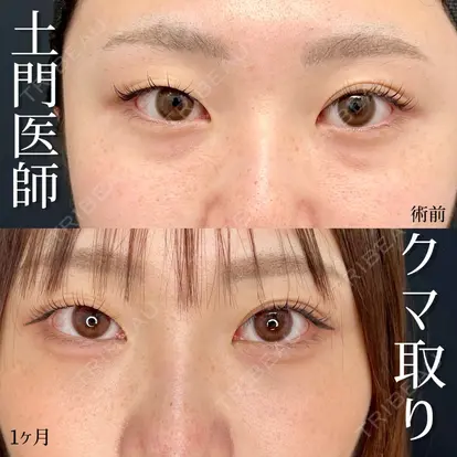 土門 一迅先生の症例
