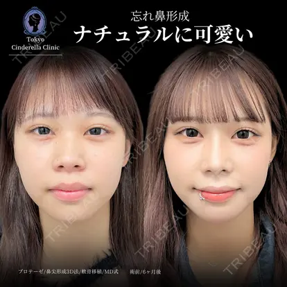 吉原 伯先生の症例