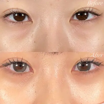 木村 尚大先生の症例