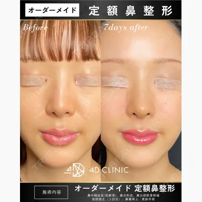 高塚 正己先生の症例