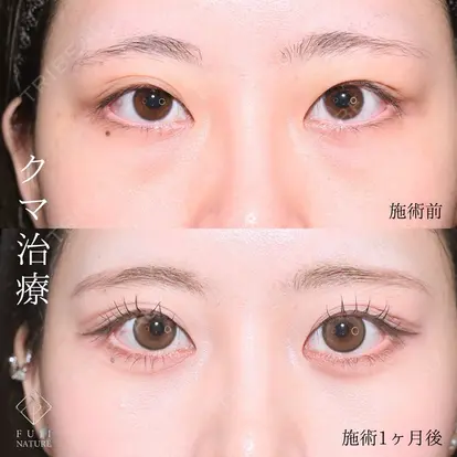 小川 杏平先生の症例
