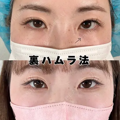 大窪 修平先生の症例