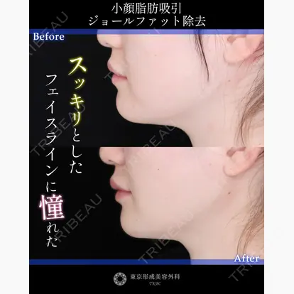 山崎 修吾先生の症例