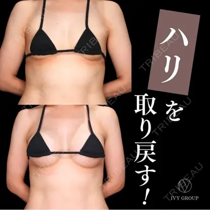 升本　浩紀先生の症例