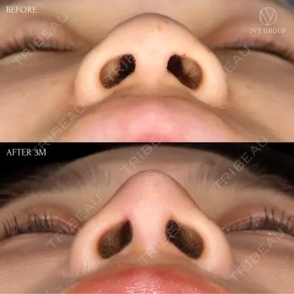 升本　浩紀先生の症例