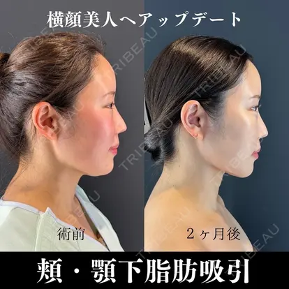 吉岡 修一先生の症例