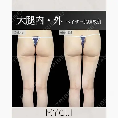 本田マイケル武史先生の症例