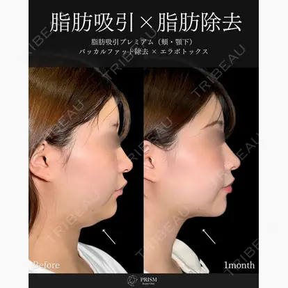 畑山 知輝先生の症例