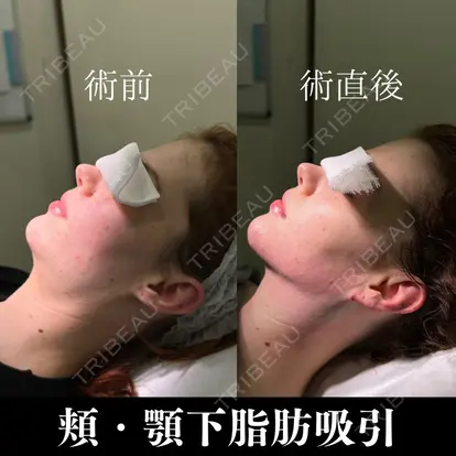 吉岡 修一先生の症例