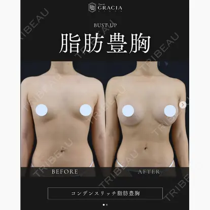 樋口 隆男 理事長先生の症例