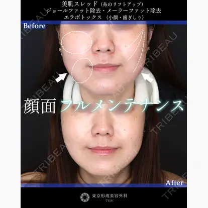 山崎 修吾先生の症例