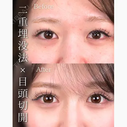 石井 達也先生の症例