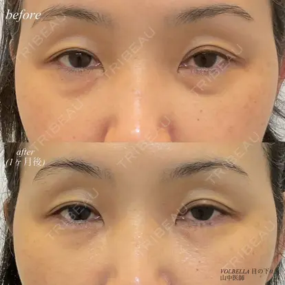 山中大介先生の症例