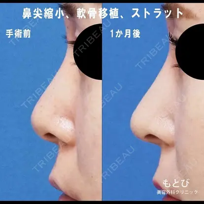 西尾 謙三郎先生の症例