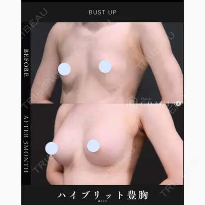吉田 直樹先生の症例