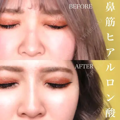 吉見　公一先生の症例