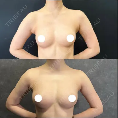 森脇 進先生の症例