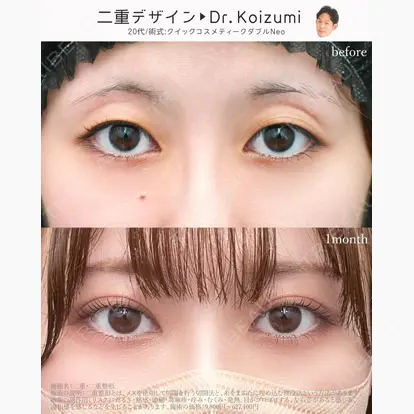 小泉 佑太先生の症例