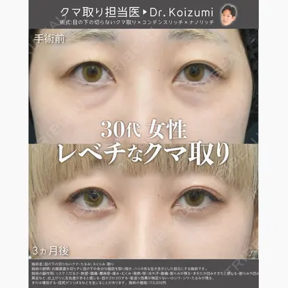 小泉 佑太先生の症例