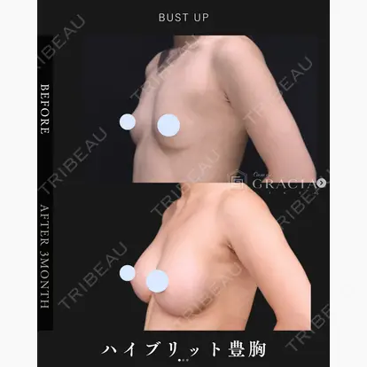 吉田 直樹先生の症例