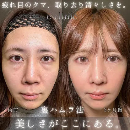 伊藤 渉先生の症例