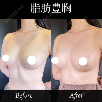 中西 友莉先生の症例