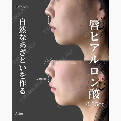 木村 潤先生の症例