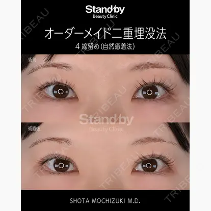 望月 聖太先生の症例