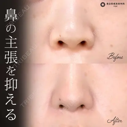弓削田　浩主先生の症例
