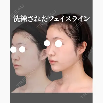 吉田 直樹先生の症例