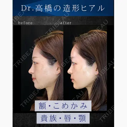 高橋京佑先生の症例