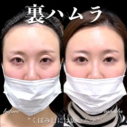 百瀬 直也先生の症例