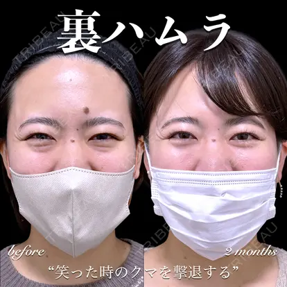 百瀬 直也先生の症例