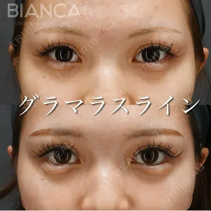 服部 有美先生の症例