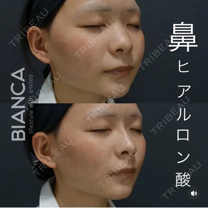 服部 有美先生の症例