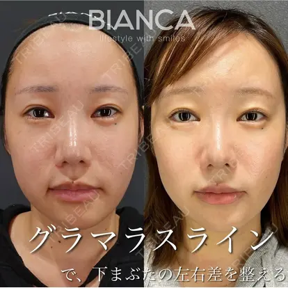 服部 有美先生の症例