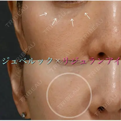 服部 有美先生の症例