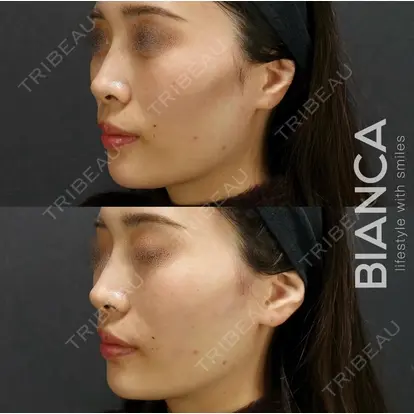 服部 有美先生の症例