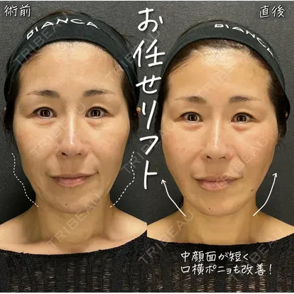 大久保 由有先生の症例