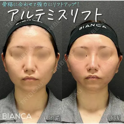 大久保 由有先生の症例