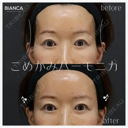 池田 雪太郎先生の症例