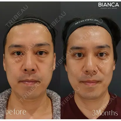 池田 雪太郎先生の症例