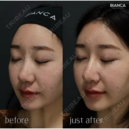 池田 雪太郎先生の症例