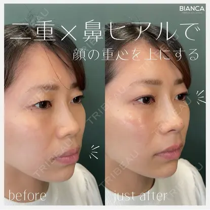 池田 雪太郎先生の症例