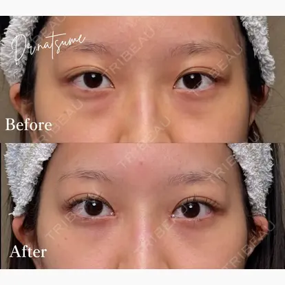 夏目 隆太郎先生の症例