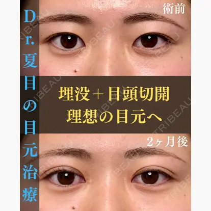 夏目 隆太郎先生の症例