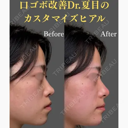 夏目 隆太郎先生の症例