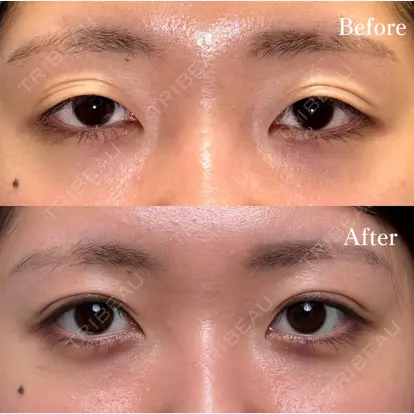 夏目 隆太郎先生の症例