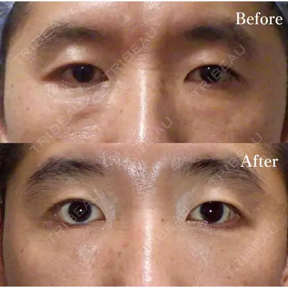 夏目 隆太郎先生の症例